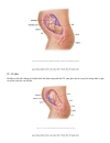 Hình Ảnh Quá Trình Phát Triển Thai Nhi