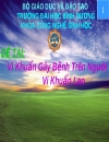 VI khuẩn lao