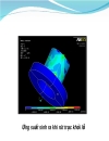 Nghiên cứu và ứng dụng ansys trong tính toán sản phẩm nón bảo hiểm 1