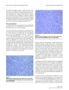 Bilateral gluteal metastases from a misdiagnosed intrapelvic gastrointestinal stromal tumor