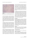 Báo cáo khoa học Inflammatory myofibroblastic tumor of epididymis a case report and review of literature