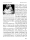 Hepatobiliary cystadenoma exhibiting morphologic changes from simple hepatic cyst shown by 11 year follow up imagings