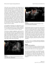 Neoangiogenesis in early cervical cancer Correlation between color Doppler findings and risk factors A prospective observational study