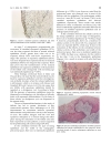 Báo cáo y học Correlation of the Radiographic and Morphological Features of the Dental Follicle of Third Molars with Incomplete Root Formation