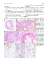 Báo cáo y học Immunohistochemical Characteristics of Bone Forming Cells in Pleomorphic Adenoma