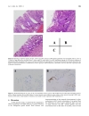 Báo cáo y học In vivo bactericidal activities of Japanese rice fluid against H pylori in a Mongolian gerbil model