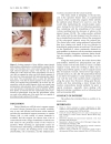 Báo cáo y học An innovative method to evaluate the suture compliance in sealing the surgical wound lip