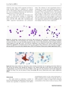 Báo cáo y học Evaluation of Fractional Analysis of Bronchoalveolar Lavage Combined with Cellular Morphological Features