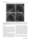 Báo cáo y học Pravastatin Provides Antioxidant Activity and Protection of Erythrocytes Loaded Primaqe