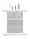 Báo cáo y học BRCA1 May Modulate Neuronal Cell Cycle Re Entry in Alzheimer Disease