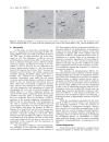 Báo cáo y học BRCA1 May Modulate Neuronal Cell Cycle Re Entry in Alzheimer Disease