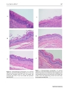 Báo cáo y học Influence of Cyclodextrin Complexation with NSAIDs on NSAID Cold Stress Induced Gastric Ulceration in Rats