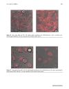 Báo cáo y học Autofluorescent Proteins as Photosensitizer in Eukaryonte