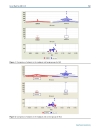 Báo cáo y học the Value of Serum Biomarkers Bc1 Bc2 Bc3 in the Diagnosis of Early Breast Cancer