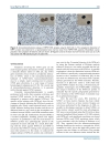 Báo cáo y học Monoclonal Antibodies against Nucleophosmin Mutants Potentials for the Detection of Acute Myeloid Leukemia