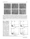 Báo cáo y học Preparation of RGD modified Long Circulating Liposome Loading Matrine and its in vitro Anti cancer Effects