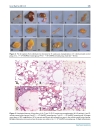 Báo cáo y học Effects of Expanded Human Adipose Tissue Derived Mesenchymal Stem Cells on the Viability of Cryopreserved Fat Grafts in the Nude Mous