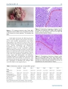 Báo cáo y học Experimental ablation of the pancreas with high intensity focused ultrasound HIFU in a porcine model