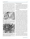 Báo cáo y học Experimental ablation of the pancreas with high intensity focused ultrasound HIFU in a porcine model