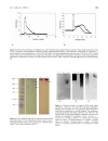 Báo cáo y học The characterisation of mucin in a mature ovarian teratoma occurring in an eight year old patient