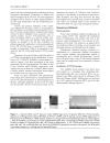 Báo cáo y học Factors affecting the long term response to tacrolimus in renal transplant patients Pharmacokinetic and pharmacogenetic approac