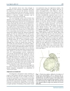 Báo cáo y học Aplasia and Agenesis of the Frontal Sinus in Turkish Individuals A Retrospective Study Using Dental Volumetric Tomograph