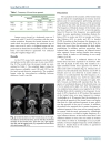 Báo cáo y học Aplasia and Agenesis of the Frontal Sinus in Turkish Individuals A Retrospective Study Using Dental Volumetric Tomograph