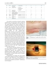 Báo cáo y học Vacuum assisted closure in the treatment of early hip joint infection