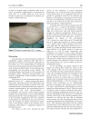 Báo cáo y học Vacuum assisted closure in the treatment of early hip joint infection