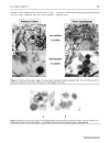 Báo cáo y học ISOLATION OF CHLAMYDIA PNEUMONIAE FROM SERUM SAMPLES OF THE PATIENTS WITH ACUTE CORONARY SYNDROME