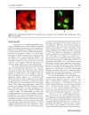 Báo cáo y học ISOLATION OF CHLAMYDIA PNEUMONIAE FROM SERUM SAMPLES OF THE PATIENTS WITH ACUTE CORONARY SYNDROME