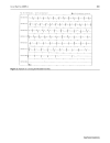 Báo cáo y học Differentiation of convulsive syncope from epilepsy with an implantable loop recorder Khalil Kanjwal Beverly Karabin Yousuf Kanjwal Blair P Grubb