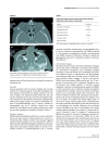 Báo cáo khoa học Effect of the medical emergency team on long term mortality following major surgery