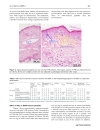 Báo cáo y học Effect of corticosteroids on phlebitis induced by intravenous infusion of antineoplastic agents in rabbits