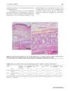 Báo cáo y học Effect of corticosteroids on phlebitis induced by intravenous infusion of antineoplastic agents in rabbits