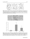 Báo cáo y học 1 25 dihydroxyvitamin D3 decreases adriamycin induced podocyte apoptosis and loss