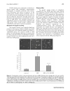 Báo cáo y học 1 25 dihydroxyvitamin D3 decreases adriamycin induced podocyte apoptosis and loss