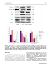 Báo cáo y học 1 25 dihydroxyvitamin D3 decreases adriamycin induced podocyte apoptosis and loss