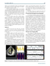 Báo cáo y học Segment orientated analysis of two dimensional strain and strain rate as assessed by velocity vector imaging in patients with acute myocardial infarction