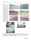 Báo cáo y học Effects of Losartan on expression of connexins at the early stage of atherosclerosis in rabbits