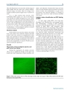 Báo cáo y học ntravenous transplantation of allogeneic bone marrow mesenchymal stem cells and its directional migration to the necrotic femoral head