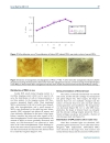 Báo cáo y học ntravenous transplantation of allogeneic bone marrow mesenchymal stem cells and its directional migration to the necrotic femoral head