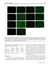 Báo cáo y học ntravenous transplantation of allogeneic bone marrow mesenchymal stem cells and its directional migration to the necrotic femoral head