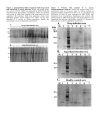 Báo cáo y học A comparative analysis of antibody repertoire against Staphylococcus aureus antigens in Patients with Deep Seated versus Superficial staphylococcal Infections