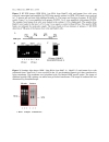 Báo cáo y học Study of the early steps of the Hepatitis B Virus life cycle