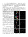 Báo cáo y học Low temperature tolerance of human embryonic stem cells