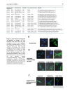 Báo cáo y học PKC and PKA Phosphorylation Affect the Subcellular Localization of Claudin 1 in Melanoma Cells