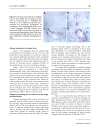 Báo cáo y học Induction and effector phase of allergic lung inflammation is independent of CCL21 CCL19 and LT beta