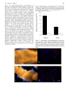 Báo cáo y học Skeletal muscle sodium glucose co transporters in older adults with type 2 diabetes undergoing resistance training