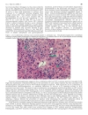 Báo cáo y học Management of HCV Infection and Liver Transplantation